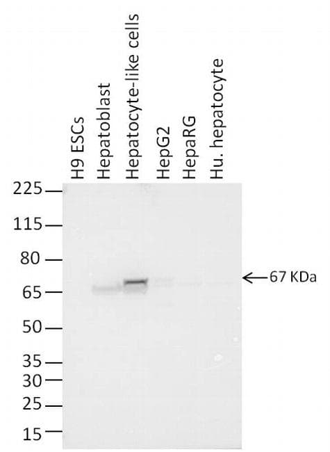 Alpha-Fetoprotein Antibody (clone P5B8)
