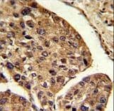 PSME2 Antibody (aa61-91)