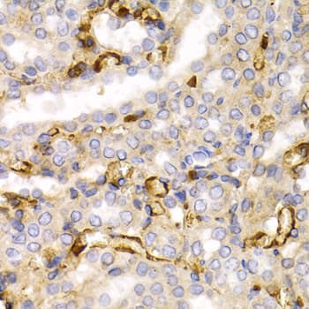 NF-L / NEFL Antibody