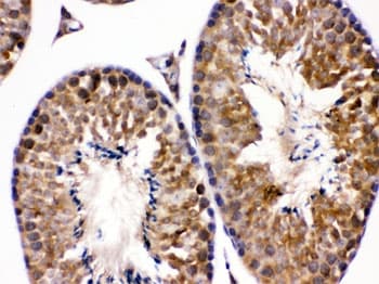 EDNRB / Endothelin B Receptor Antibody