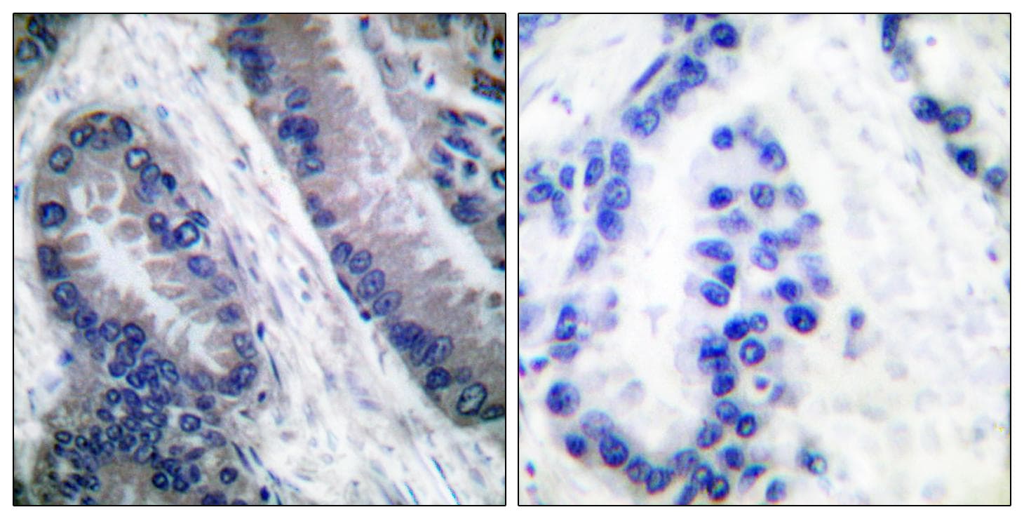 Polyclonal Rabbit anti-Human CASP1 / Caspase 1 Antibody (Cleaved-Asp210, IHC)