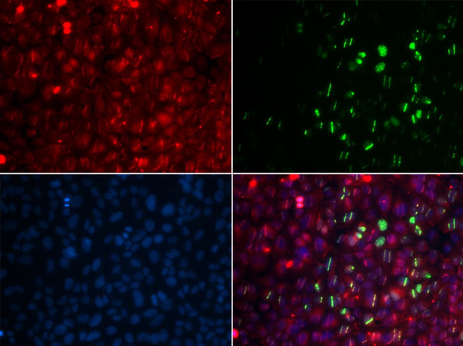 RAD18 Antibody