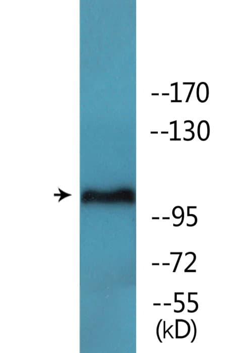 FAK / Focal Adhesion Kinase Antibody (phospho-Tyr397)