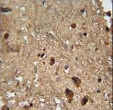 Polyclonal Rabbit anti-Human RAN Antibody (aa112-140, IHC, WB)