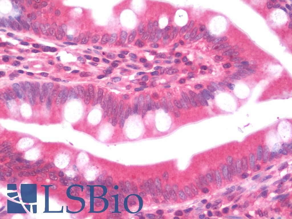 IHC-plus™ AZIN2 / Antizyme Inhibitor 2 Antibody (Internal)