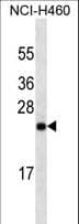 UCHL1 / PGP9.5 Antibody