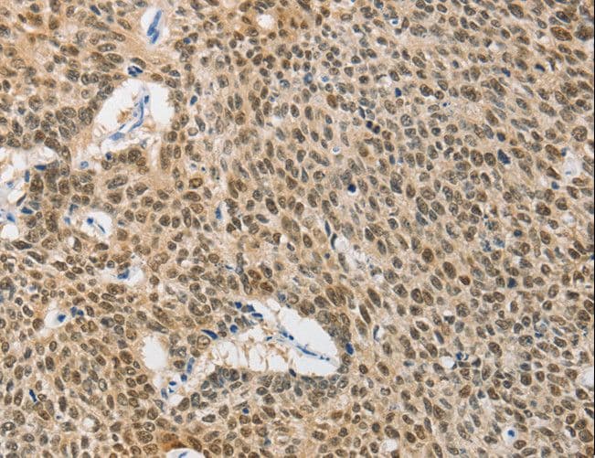 HSP40 Antibody