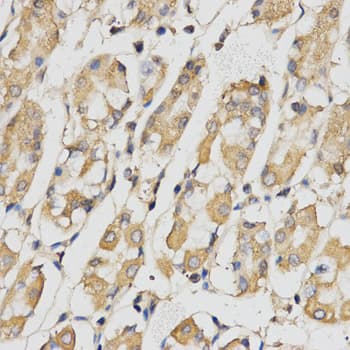 Polyclonal Rabbit anti-Human RACGAP1 / MGCRACGAP Antibody (IHC, IF, WB)