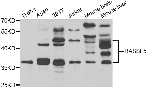 RASSF5 / RAPL Antibody