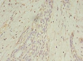 MAGE10 / MAGEA10 Antibody (aa2-225)