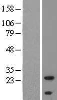 Human ALMS1 Protein (Over-Expression Lysate Myc-DDK (Flag))