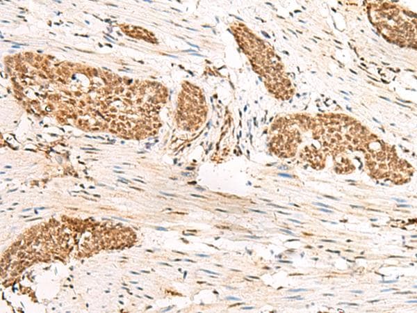 HUS1 Antibody