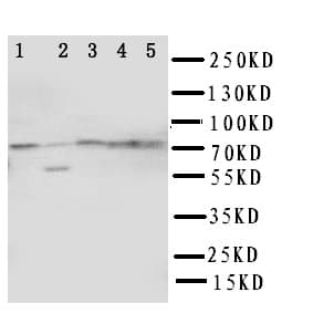 Polyclonal Rabbit anti-Human ABCG1 Antibody (aa627-647, WB)