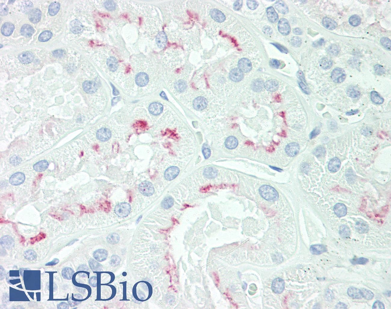 IHC-plus™ AQP3 / Aquaporin 3 Antibody (aa163-191)