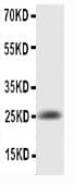 IL6 / Interleukin 6 Antibody (aa25-211)