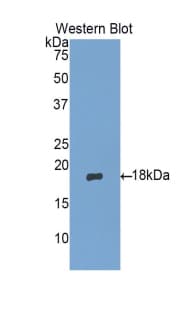 MGP / Matrix Gla-Protein Antibody (aa20-103)