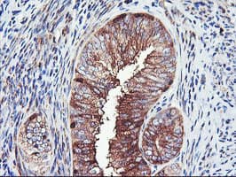 PFKP Antibody (clone OTI1D6)