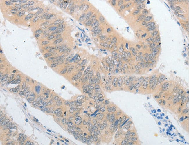 PAP2a / PPAP2A Antibody