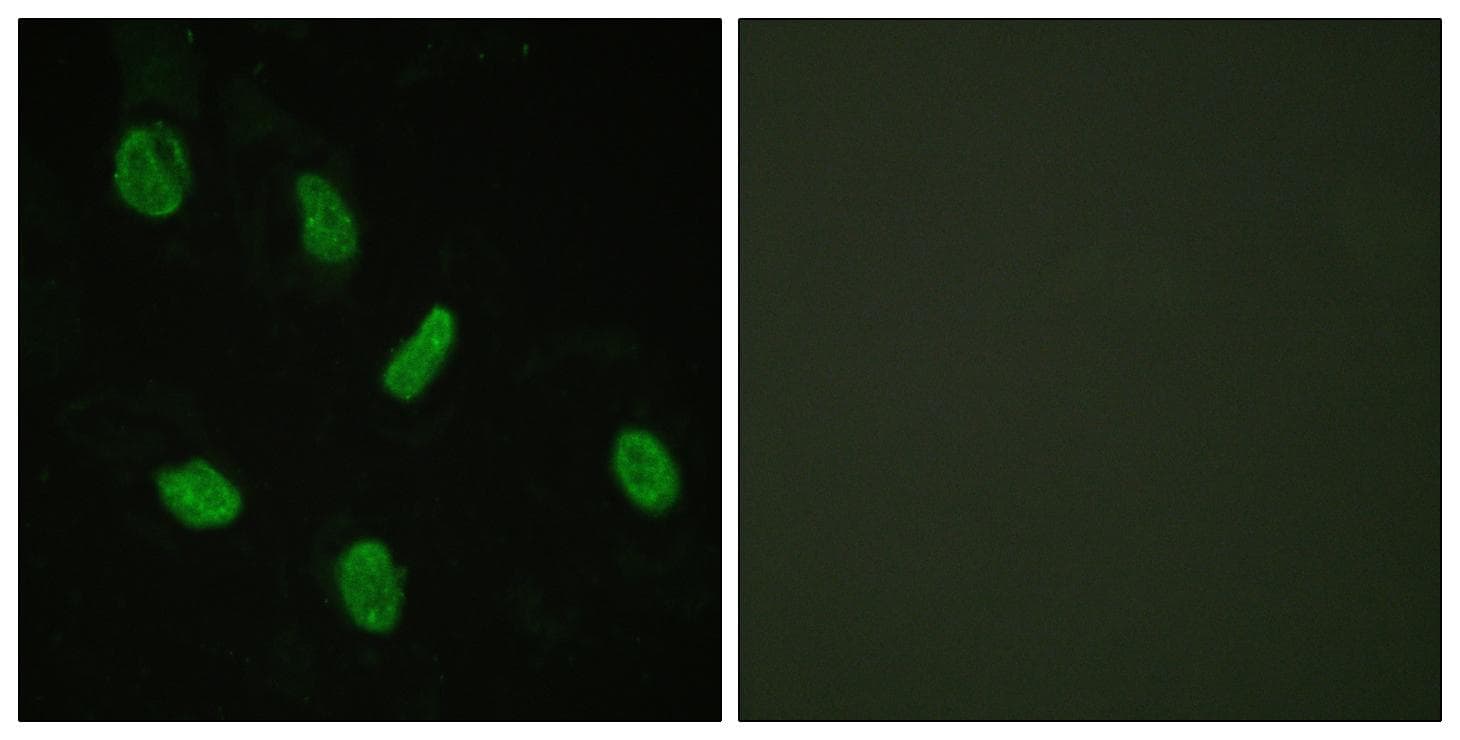 Polyclonal Rabbit anti-Human AR / Androgen Receptor Antibody (Ab-94, IHC, IF)