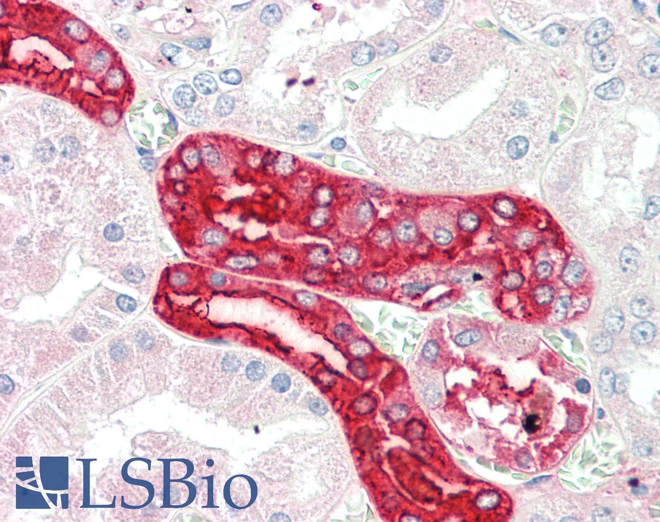IHC-plus™ MEX3C Antibody (aa541-554)