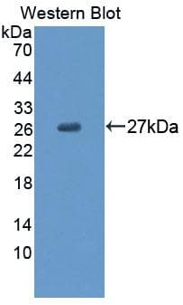 COT / CROT Antibody (aa410-612, APC, Cy7)