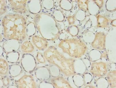 Polyclonal Rabbit anti-Human TBCB / CKAP1 Antibody (IHC, WB)