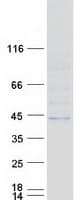 Human B3GALT5 Protein (Recombinant Myc-DDK (Flag))