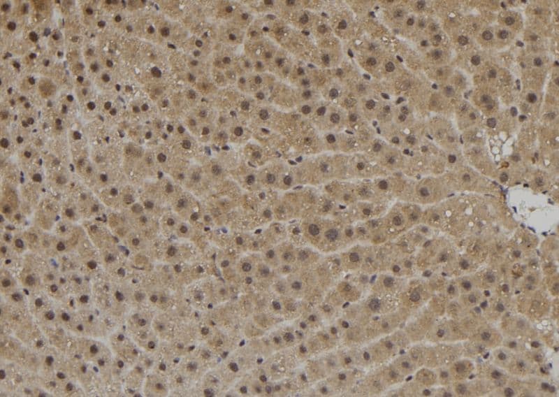 Polyclonal Rabbit anti-Human C14orf131 / ZNF839 Antibody (IHC, WB)