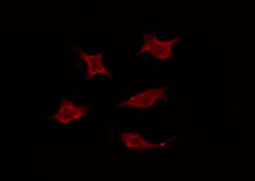 Polyclonal Rabbit anti-Human LPAR3 / LPA3 / EDG7 Antibody (IF, WB)