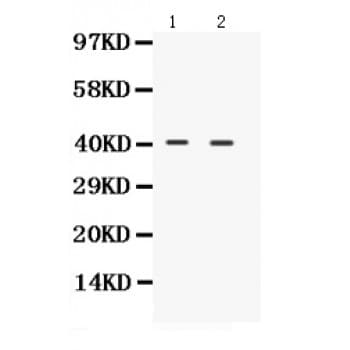 NDRG2 Antibody (aa210-247)