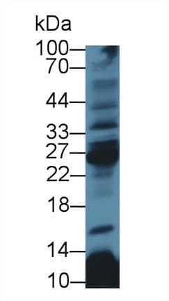 CD8B / CD8 Beta Antibody (aa22-170)