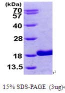Human RBP5 Protein (Recombinant His)