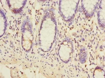TMEM93 Antibody