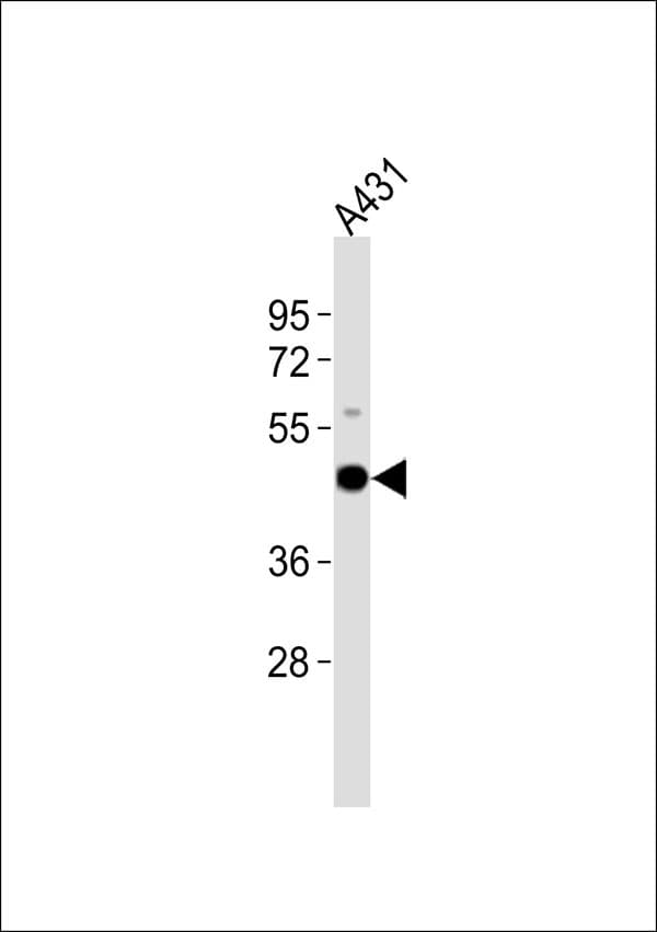 KRT18 / CK18 / Cytokeratin 18 Antibody