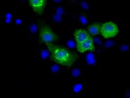 IHC-plus™ Monoclonal Mouse anti-Human MCL1 / MCL 1 Antibody (clone 2E11, IHC, IF, WB)