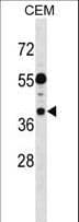 Polyclonal Rabbit anti-Human TSSC1 Antibody (aa319-348, WB)