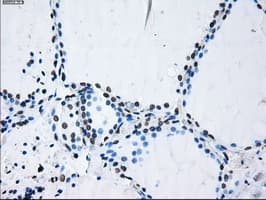 Monoclonal Mouse anti-Human ID3 Antibody (clone OTI15F4, IHC, IF, WB)
