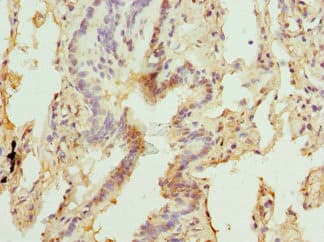 MBTPS1 / S1P Antibody