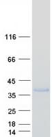 Human ACRV1/Intra-Acrosomal Protein (Recombinant Myc-DDK (Flag))