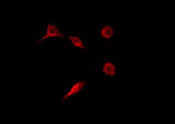 ITGB3 / Integrin Beta 3 / CD61 Antibody