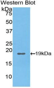STAT3 Antibody (aa135-279)