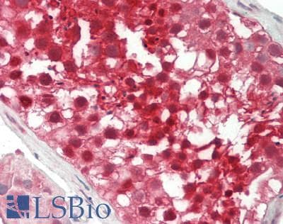 IHC-plus™ PSMB5 Antibody