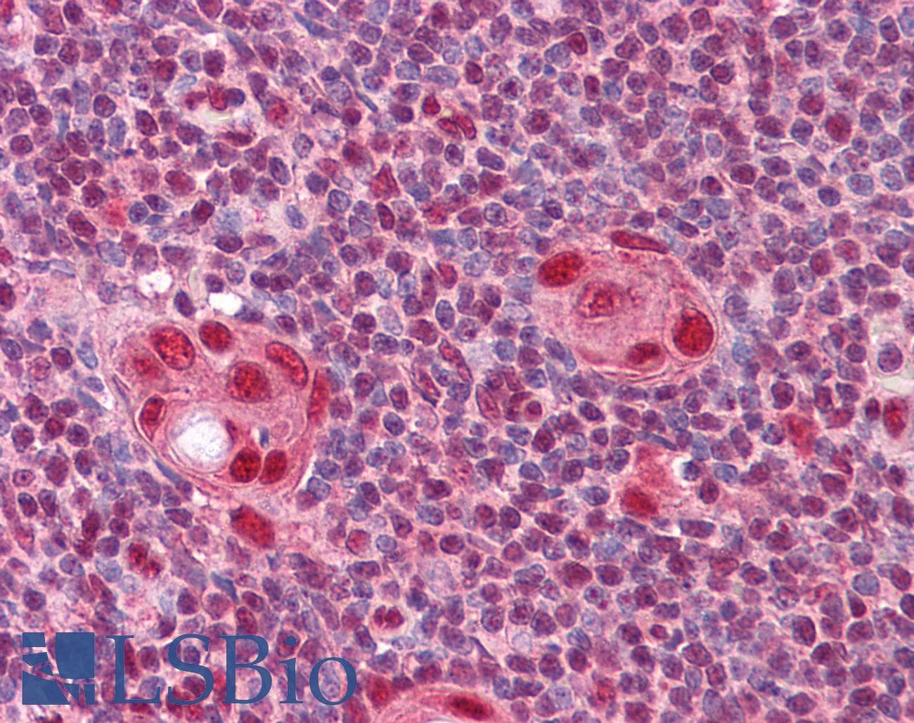 IHC-plus™ CUX1 / CASP Antibody (clone 2A10)