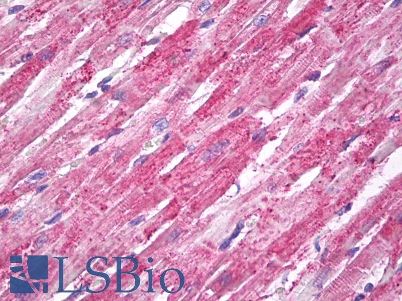 SOD2 / Mn SOD Antibody (FITC)