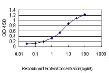 NRAS / N-ras Antibody (clone 2A3)