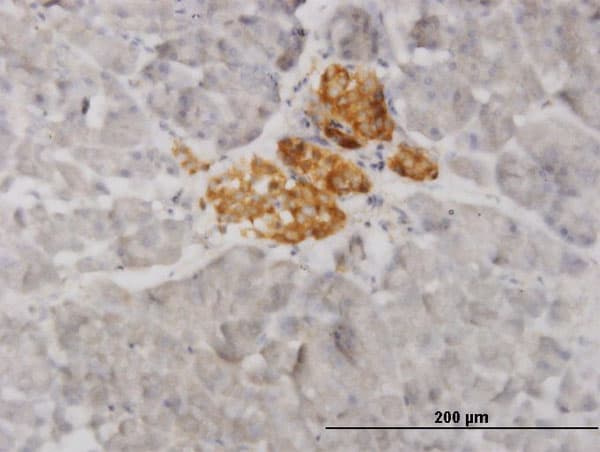 VAMP1 / VAMP-1 Antibody (clone 5A4)