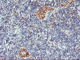 CENTG2 / AGAP1 Antibody (clone OTI4E8)