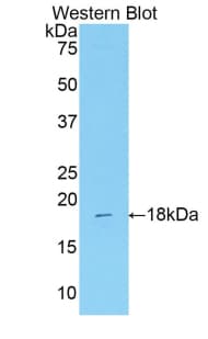 IDO2 / INDOL1 Antibody (aa84-228)