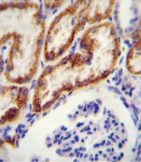 Polyclonal Rabbit anti-Human GATM / AGAT Antibody (aa58-84, IHC, WB)