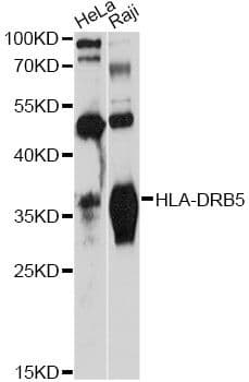 Polyclonal Rabbit anti-Human HLA-DRB5 Antibody (WB)